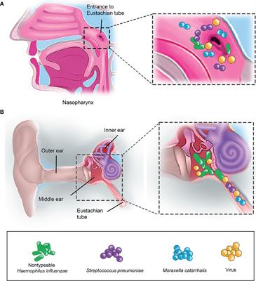 Gene Expression Regulation in Airway Pathogens: Importance for Otitis Media